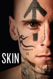 پوست / Skin