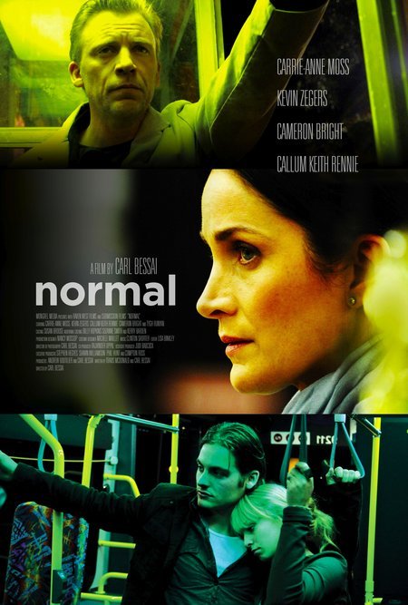normal